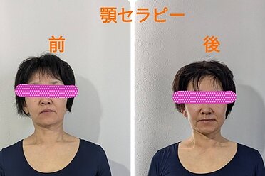 施術前後のご様子（写真）